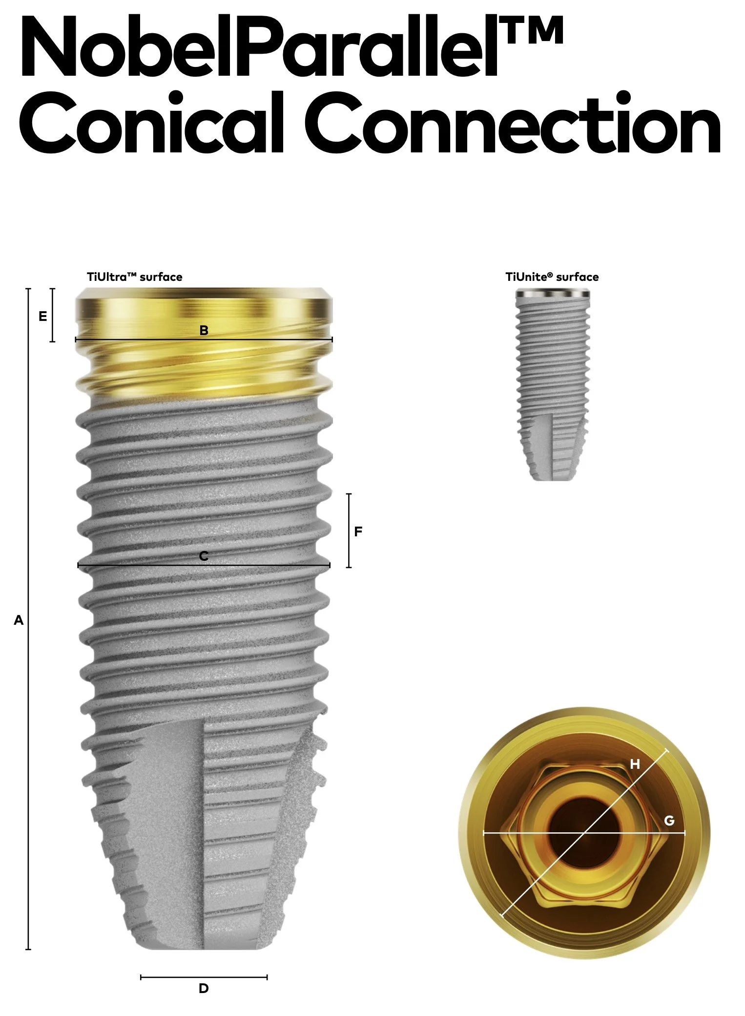 NobelParallel Dental Implant