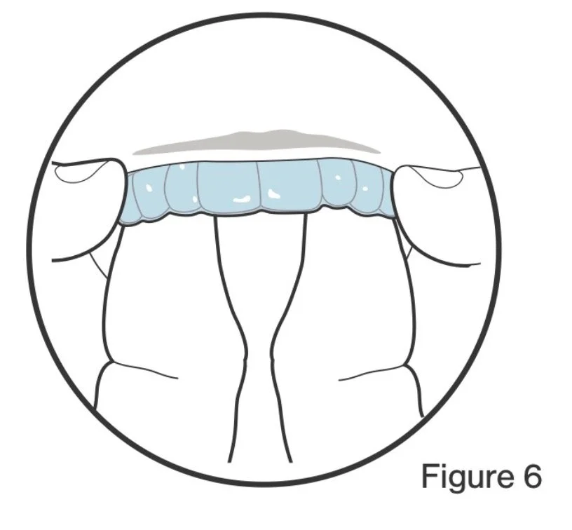 Drawing of a person's mouth with their four lower teeth visible and fingers holding the lip open.