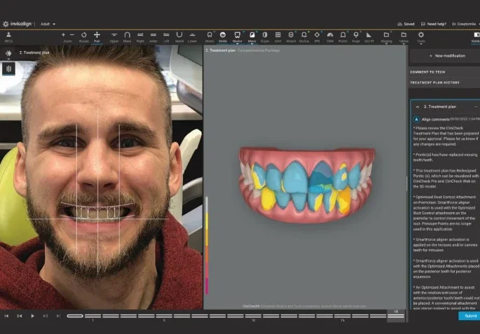 A digital dental treatment plan displayed on a computer screen, with a digital 3D model of teeth and gums showing orthodontic adjustments. A smiling man with a beard is taking a selfie in the background.