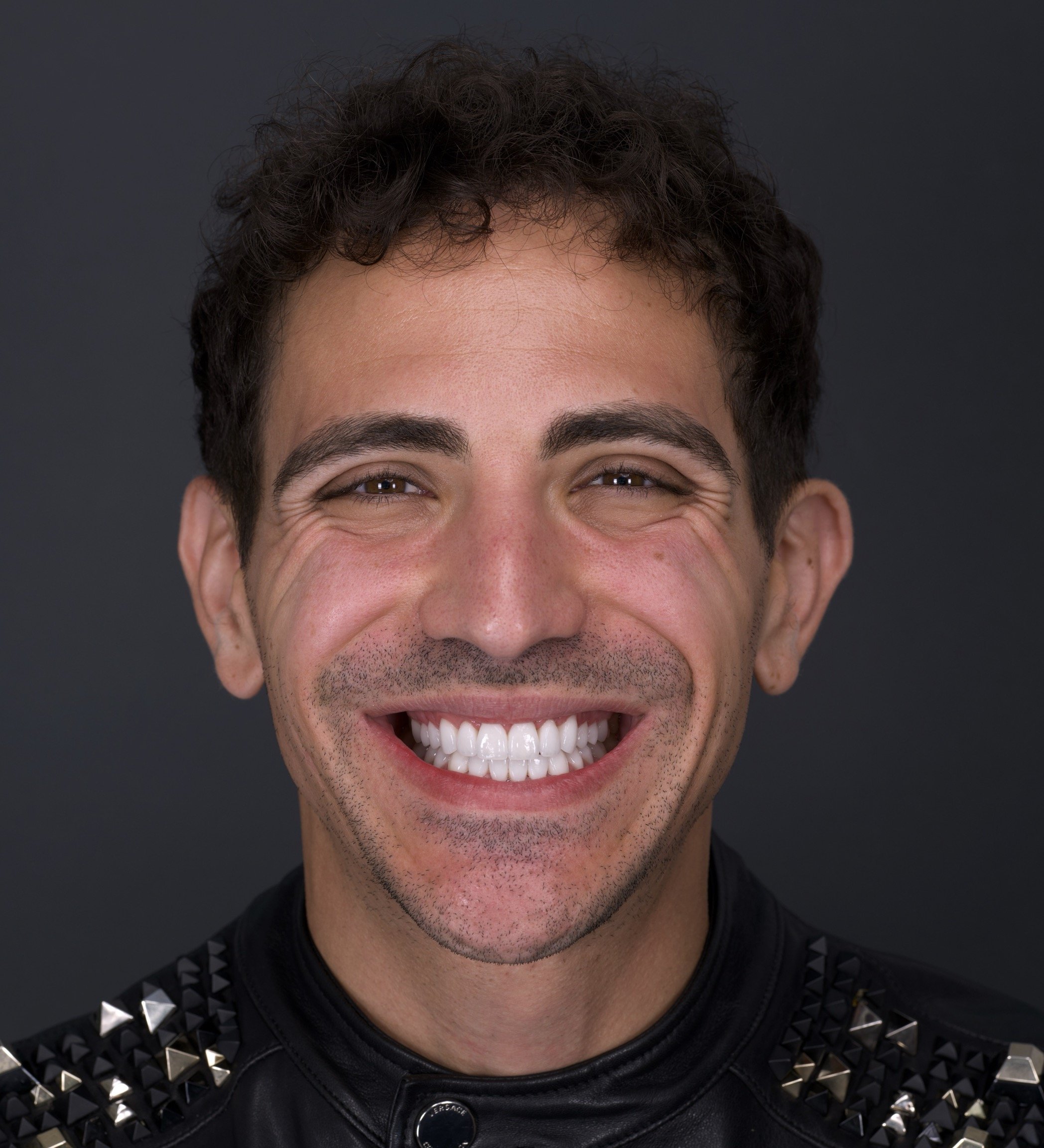 Veneers in Newport Beach by Jeremy Heldt, DDS