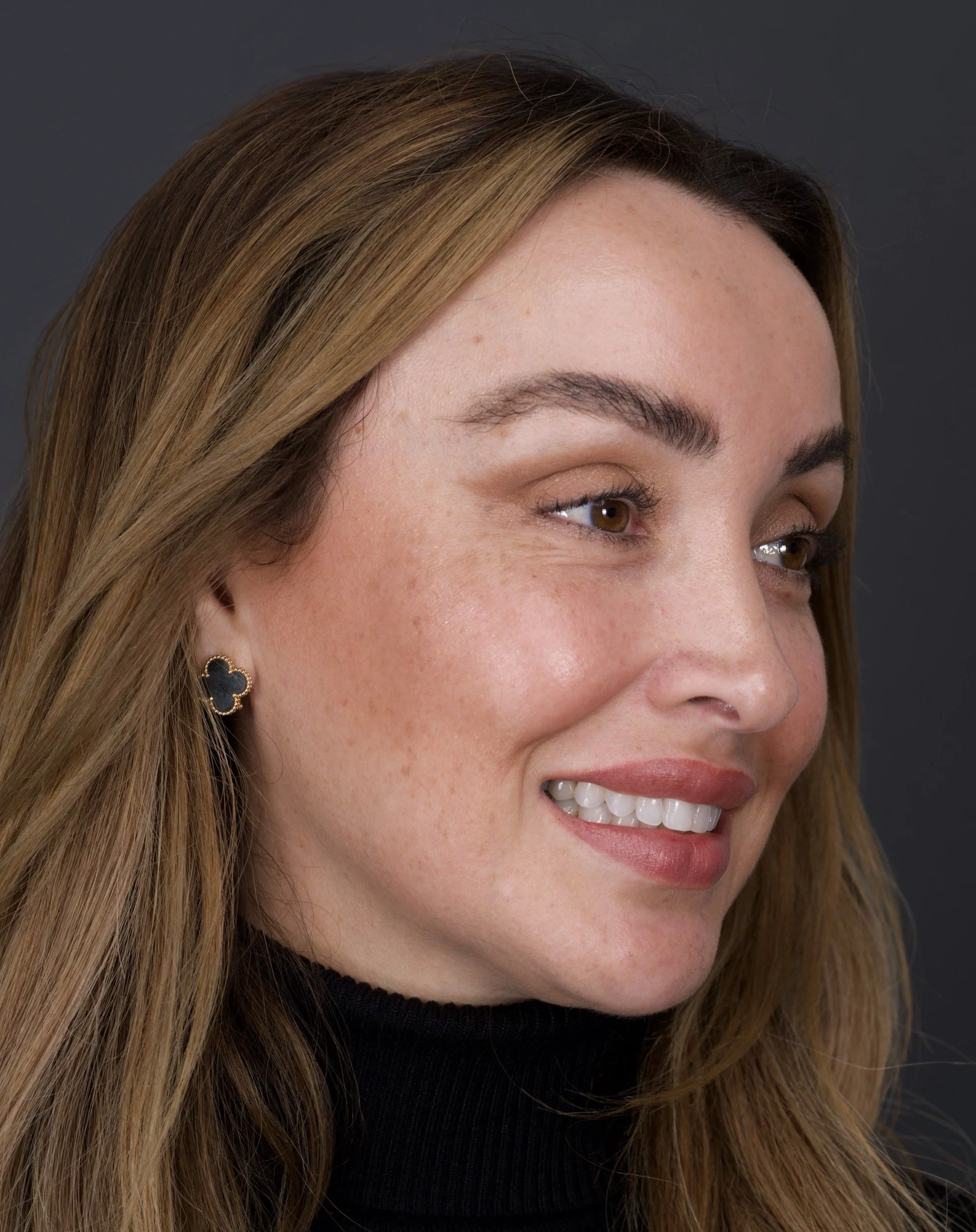 Invisalign Express + Whitening