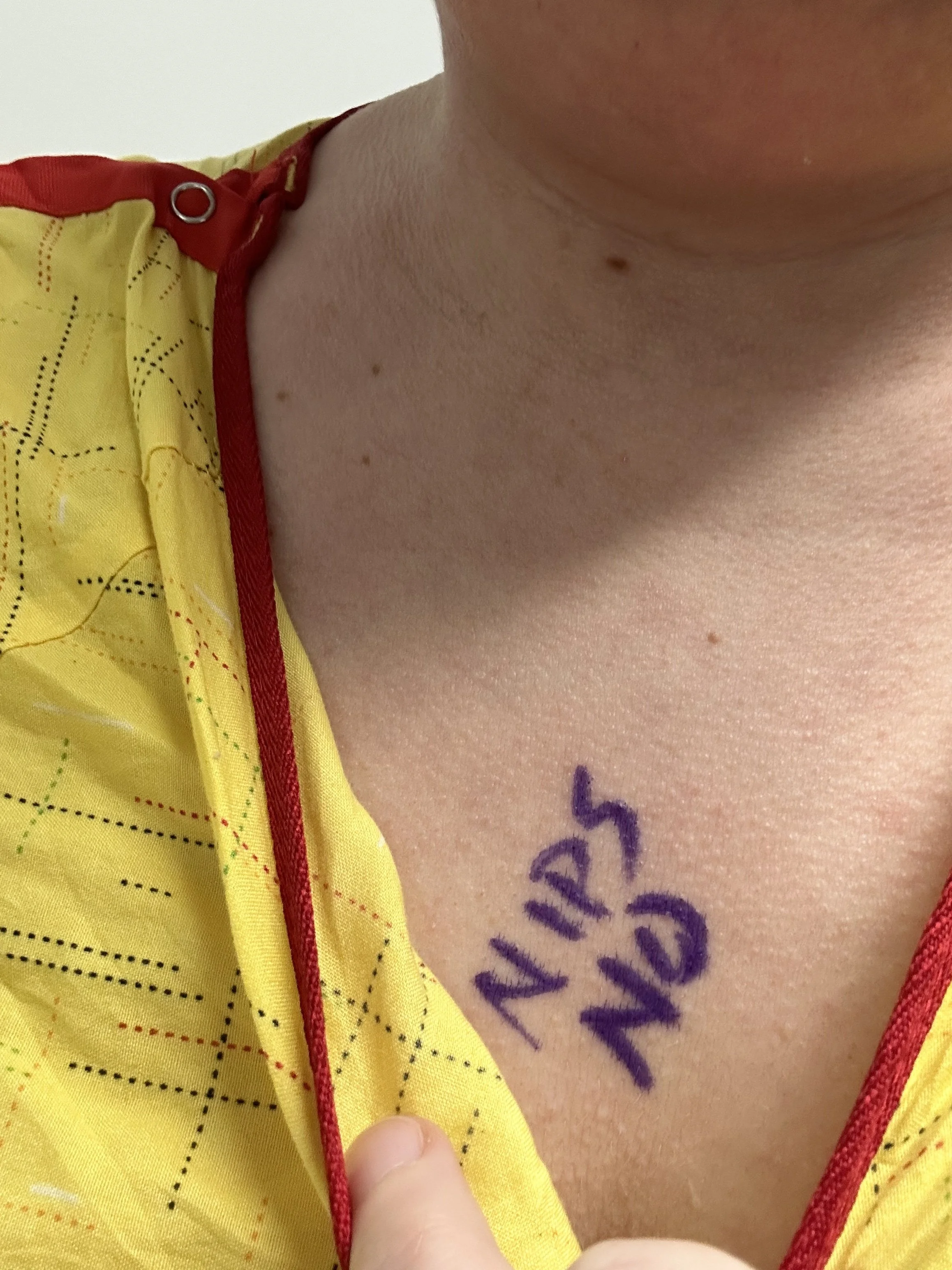 “Elective” Surgery