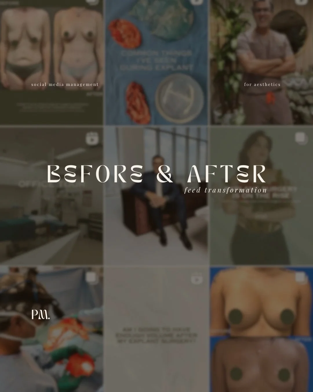 Aesthetic results deserve an aesthetic feed.
Before working with PM, the grid showed the work.
After working with PM, it shows the brand.

From visual structure to story-driven posting, we transformed Dr. Dev's feed into a cohesive, elevated reflecti