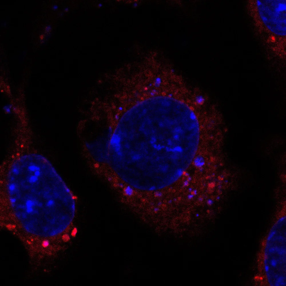 About — THE LIM LAB