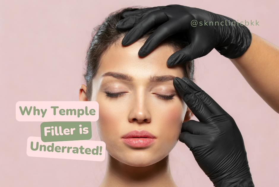 Temple Filler: The Underrated Treatment That Restores Facial Balance