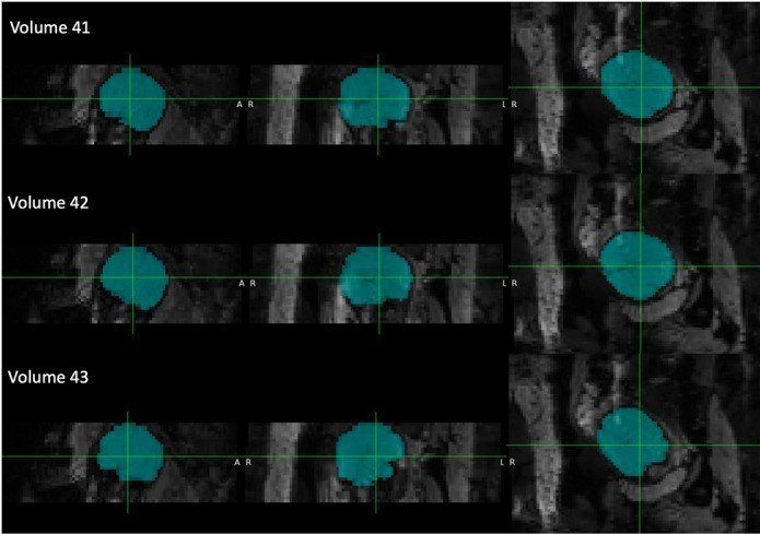 What can 12 minutes of fMRI tell you about your fetus’s brain?