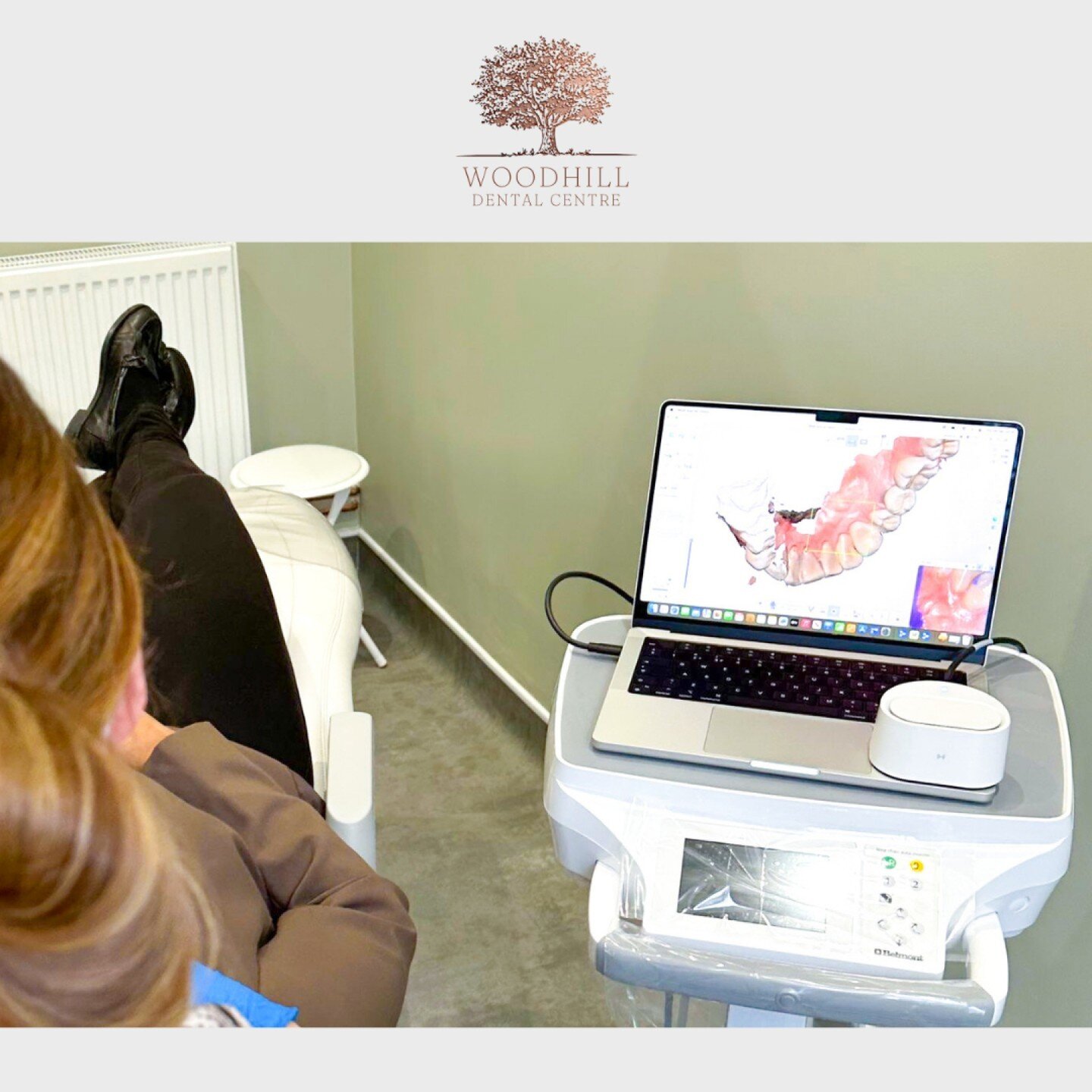 EXCITING ANNOUNCEMENT!! ⭐️

Digital Dentistry is coming to Woodhill soon, revolutionising the way we take impressions for crown and implant preps, as well as study models.

With the use of innovative technology, we're taking the discomfort and inconv