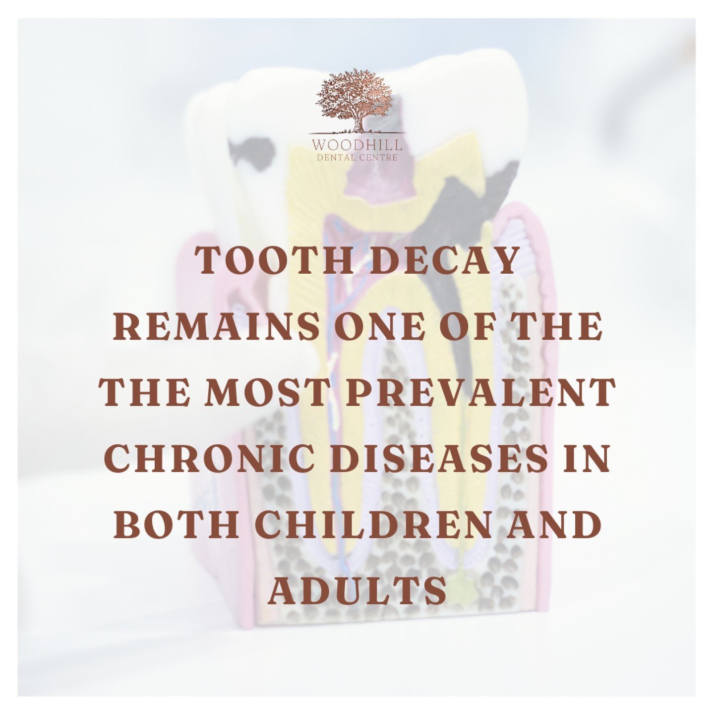 🦷🔍 Don't let tooth decay sneak up on you! Schedule your next check-up today! 📅✨

🌟 Did you know that tooth decay continues to be one of the most common chronic diseases in both children and adults? Let's take control of our oral health and preven
