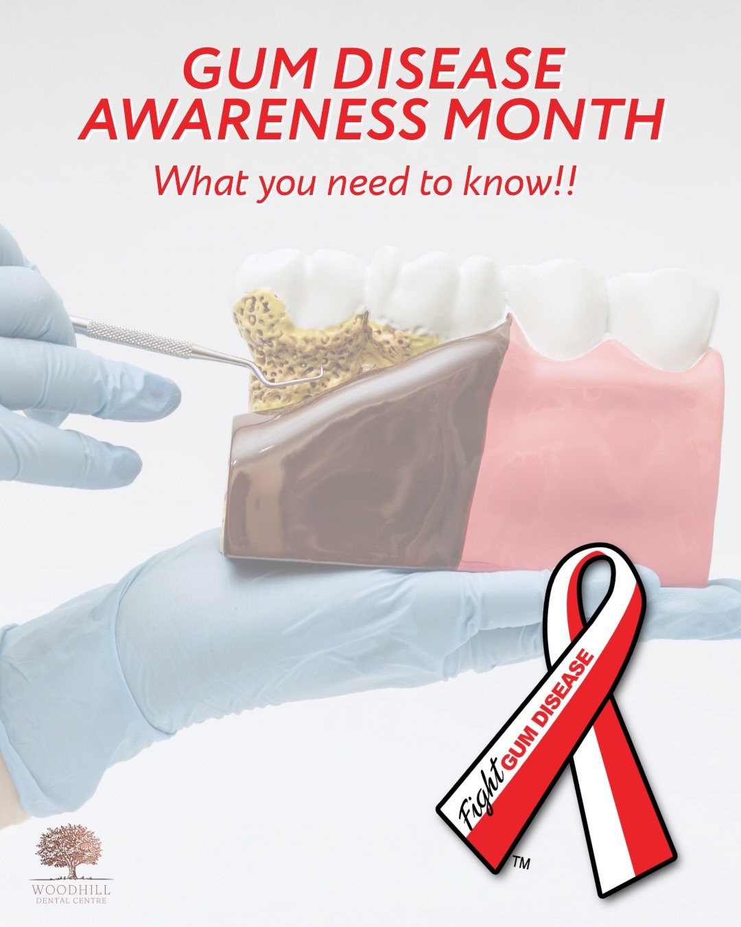 It&rsquo;s Gum Disease Awareness Month 🦷

Gum disease is very common and often develops quietly, without obvious symptoms at first. That&rsquo;s why being aware of the signs and keeping up with your routine dental and hygiene appointments is so impo