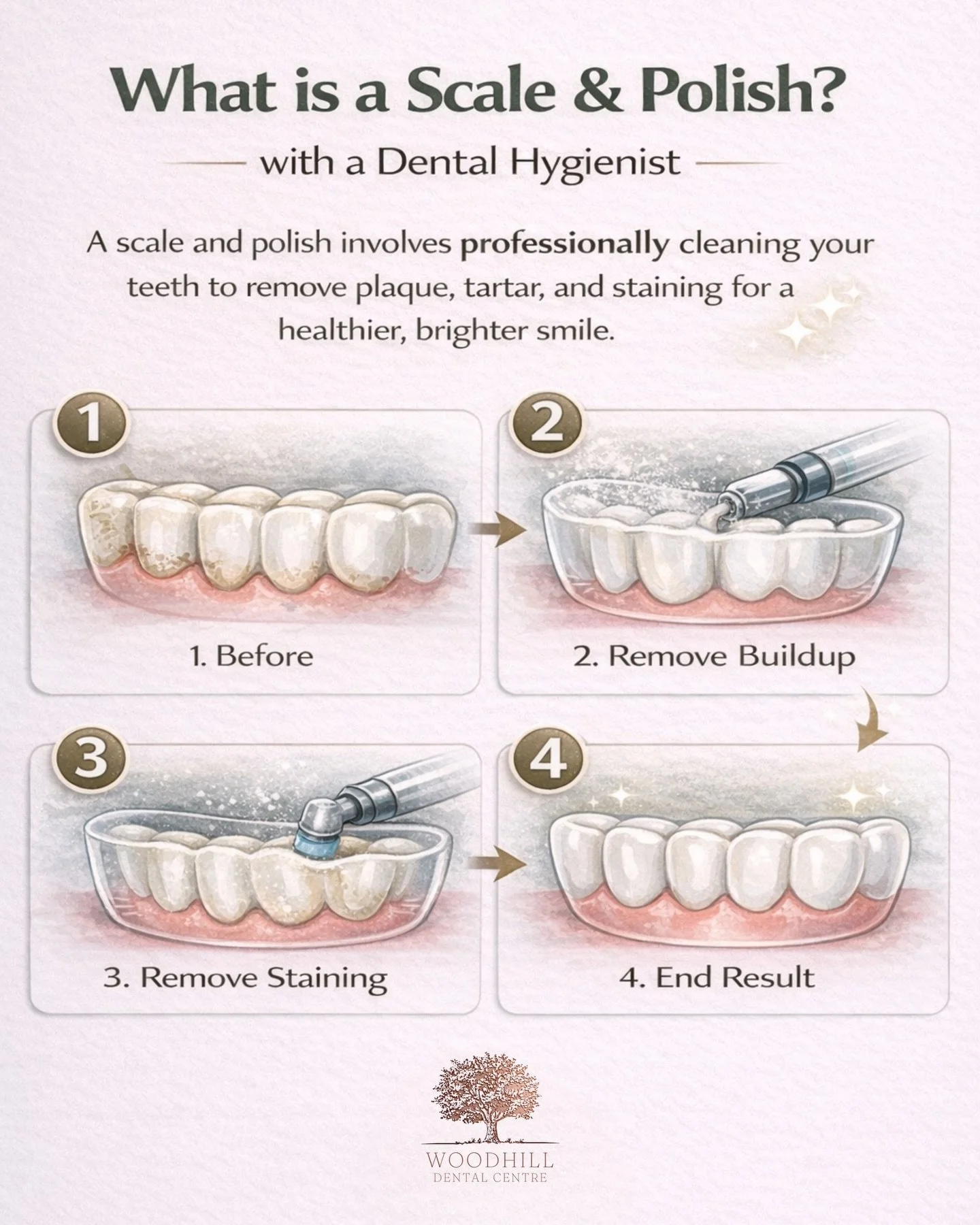 A scale and polish is a professional clean carried out by a dental hygienist to help keep your teeth and gums healthy.

It involves removing plaque and tartar build up, polishing away surface stains, and leaving your teeth feeling smooth, clean, and 