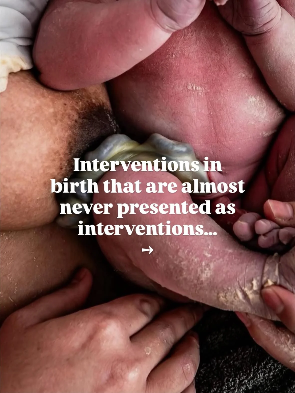 When you give your consent to an intervention during your birth it is so important that you understand what that intervention comes with - both the benefits and the risks. It gets even more difficult to navigate decision making around interventions t