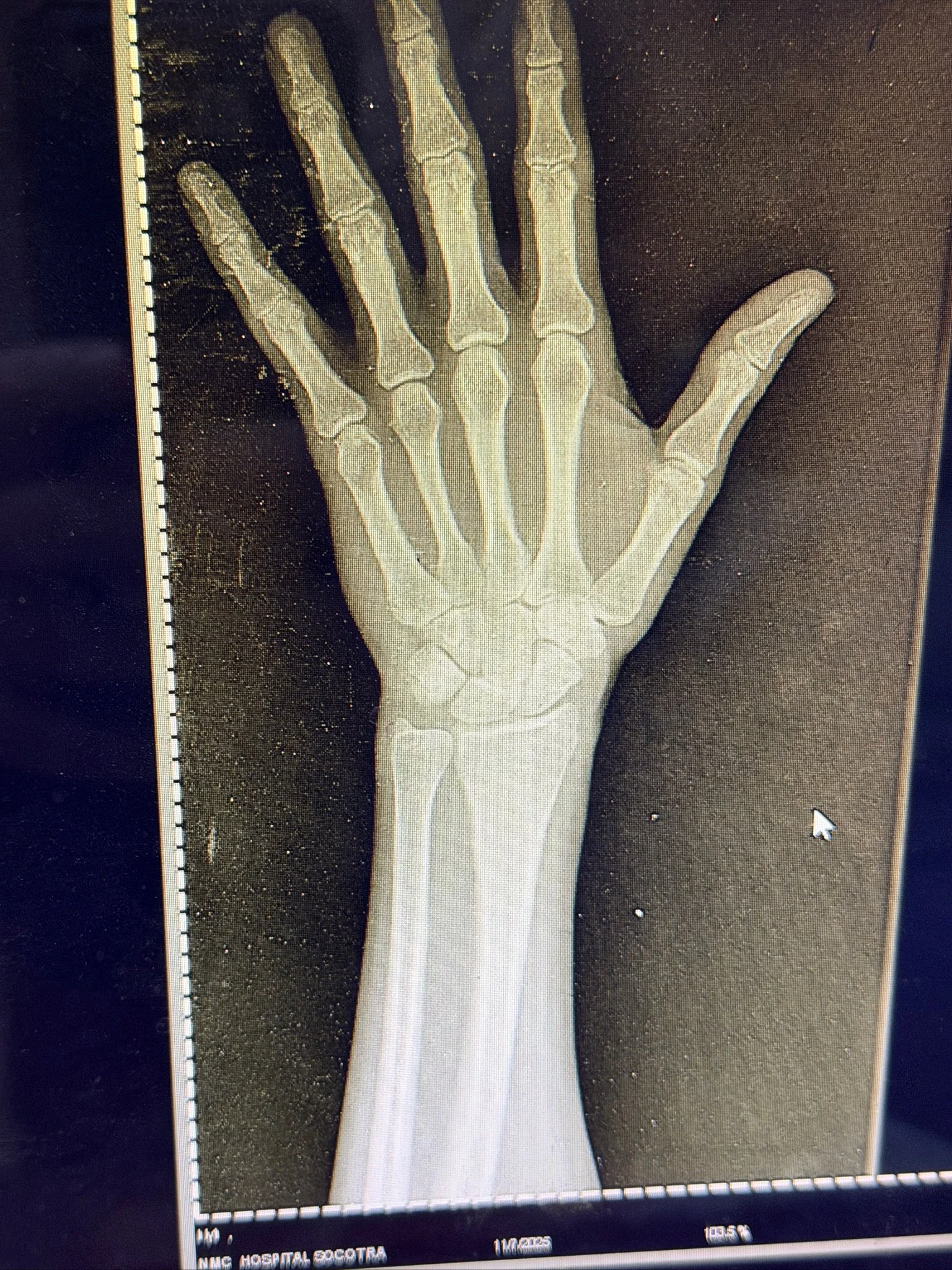 maxandhailey-travel_Yemen-socotra-Island - 12.jpeg