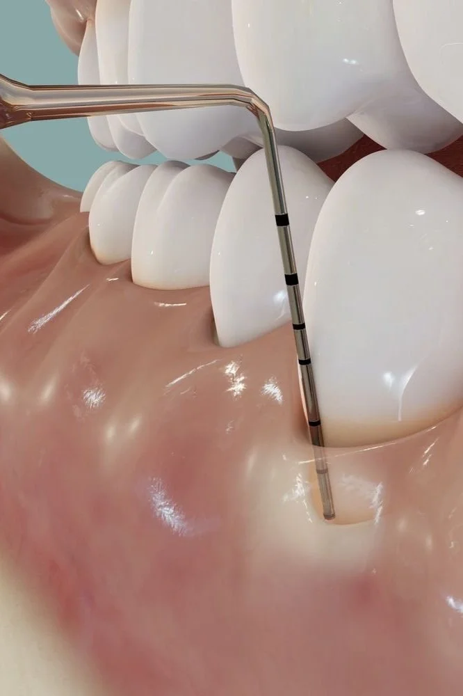 Periodoncia