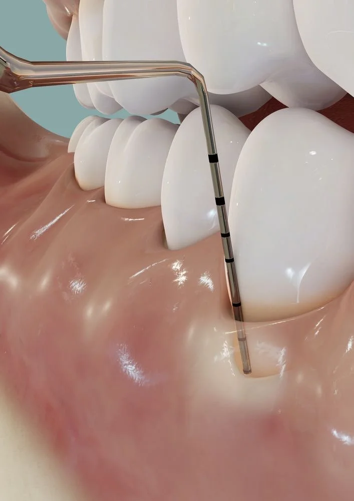 PERIODONCIA