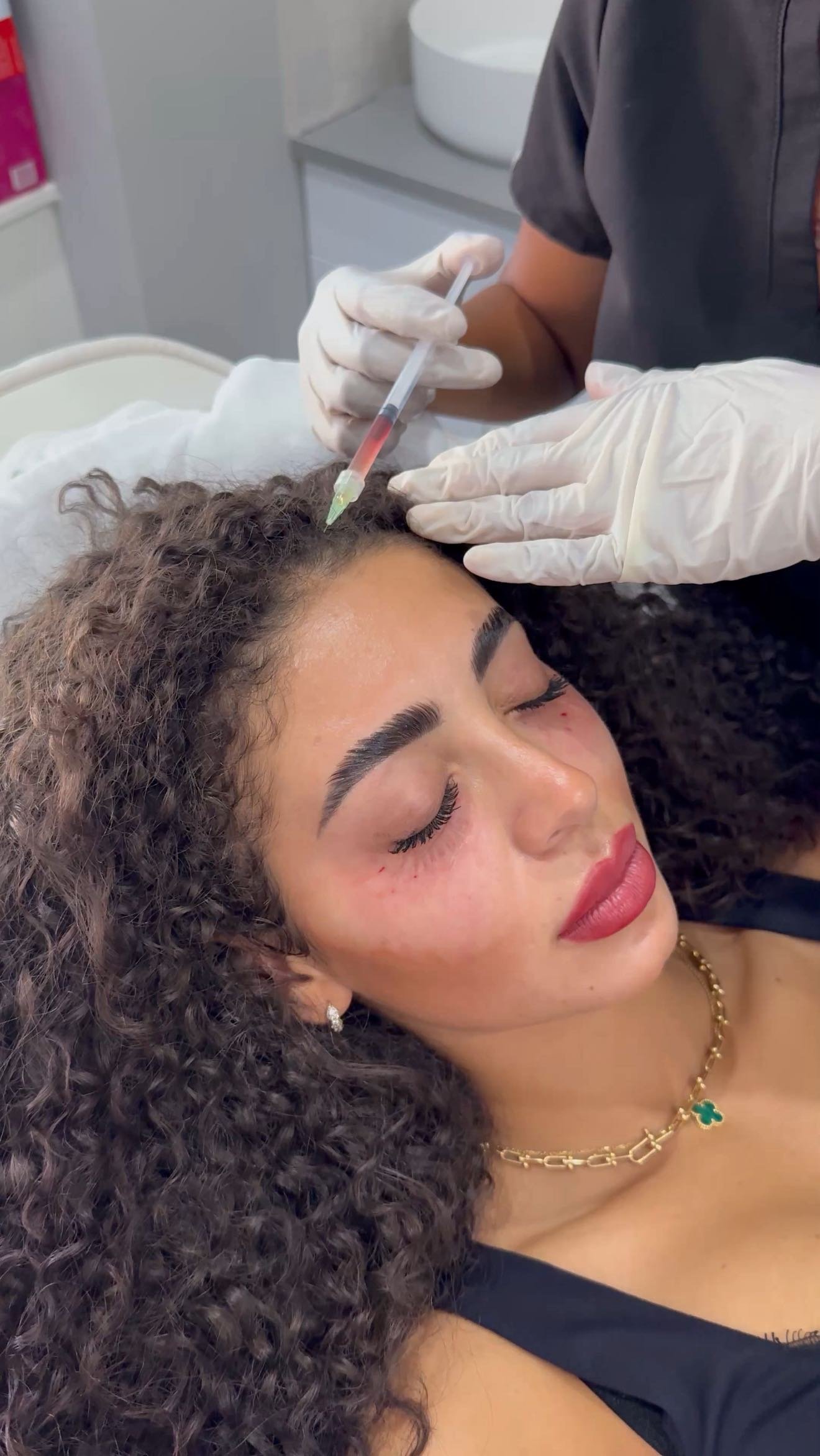 Here are 5 key benefits of PRP (Platelet-Rich Plasma) for hair restoration.
Disclaimer: Any surgical or invasive procedure Carries risks. Before proceeding you are urged to seek a second opinion from a qualified health practitioner. All results var