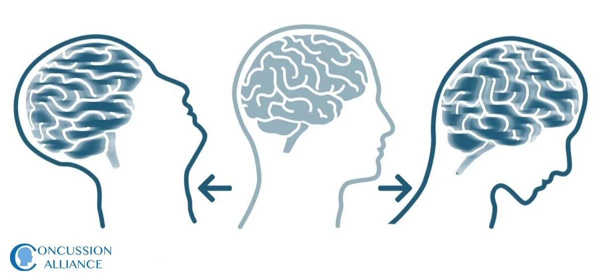 Brain deformation during head movement