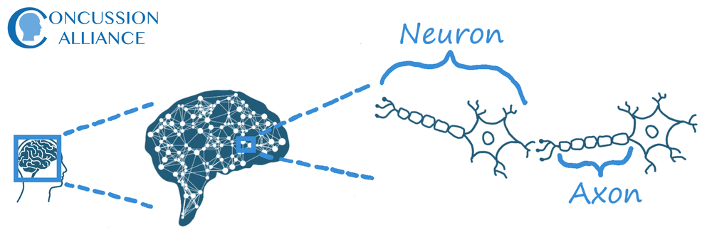 What happens to your brain when you get a concussion? — Concussion Alliance