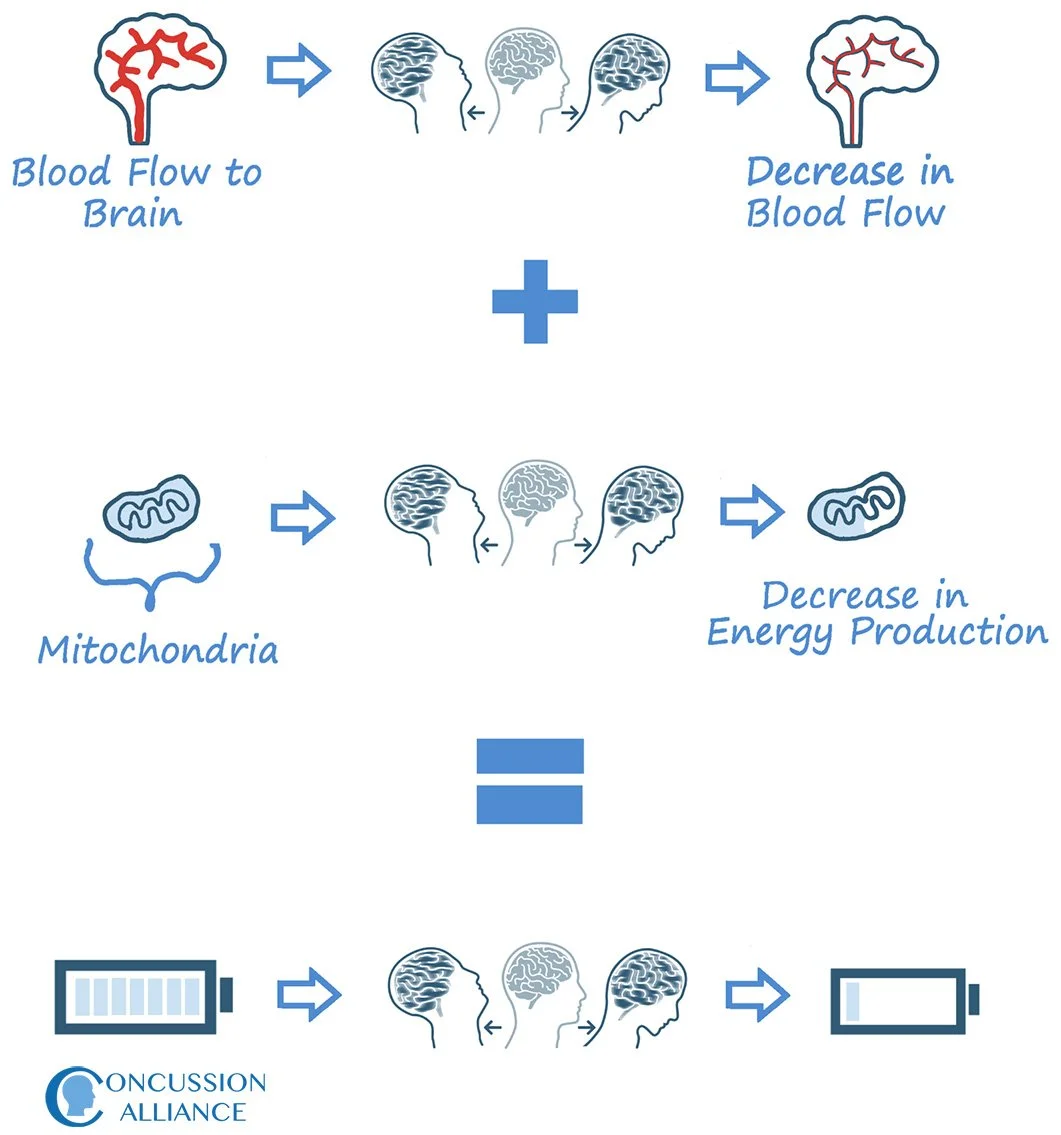 Changes in the brain after a concussion
