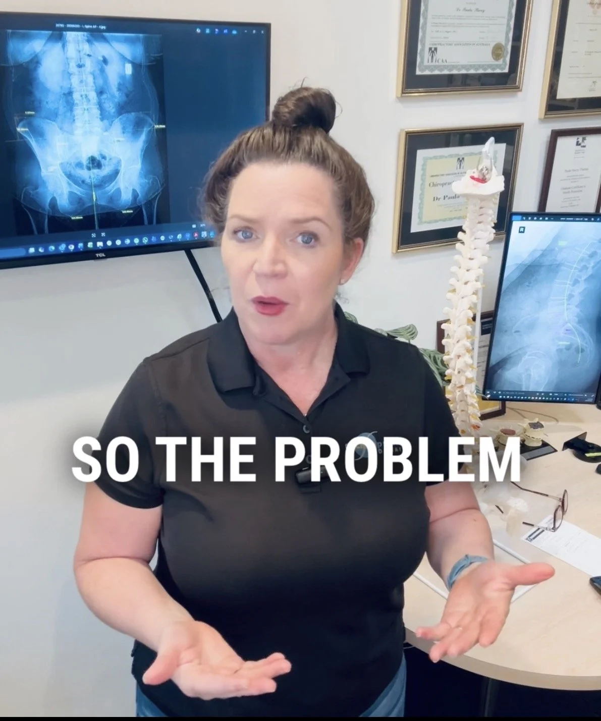 Why Does My Back “Go Out” When I Bend or Lift Something Small?