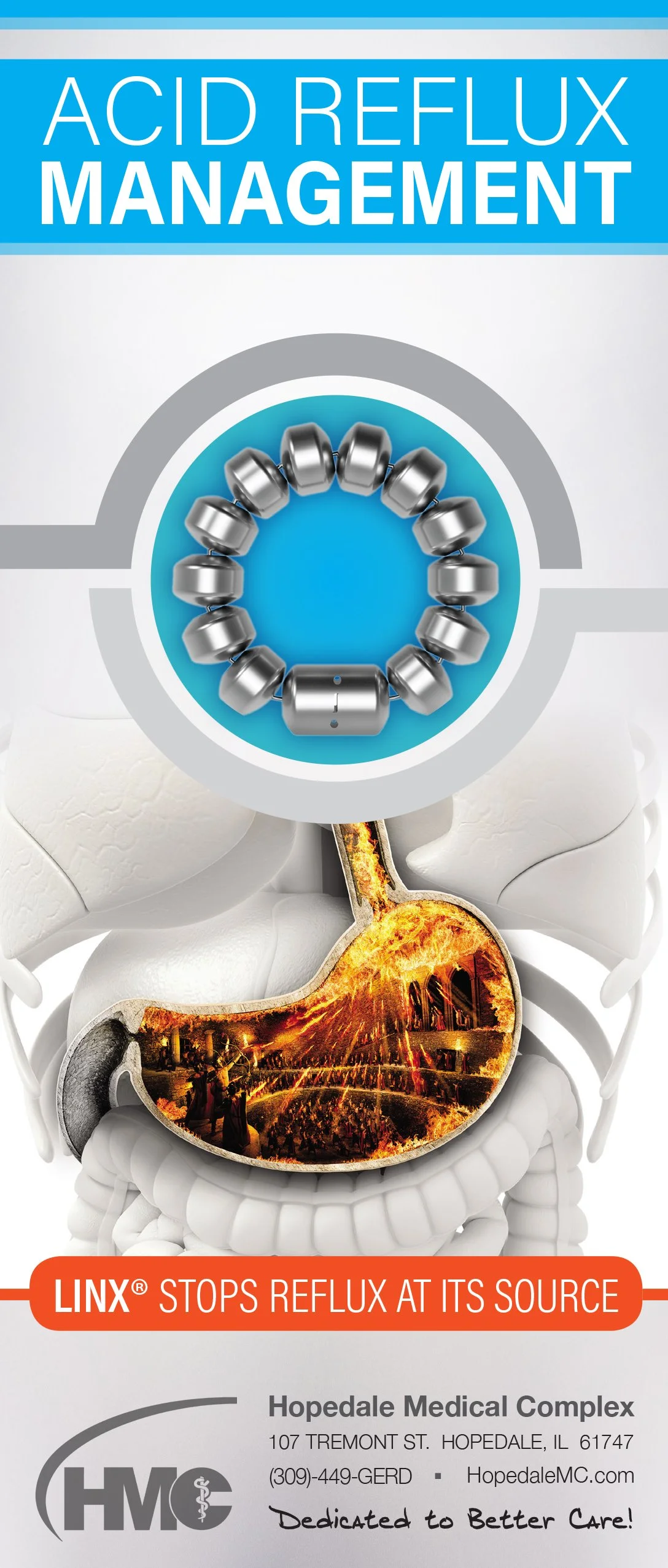 Linx-GERD_RackCard_03222018_PR-1 copy.jpg