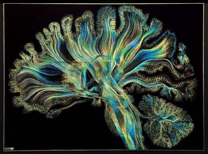 NEURO ART
How cool is this unique Neuro Art by artist @gdunnart 

#mindfulness #brainart #neurons #mentalhealth