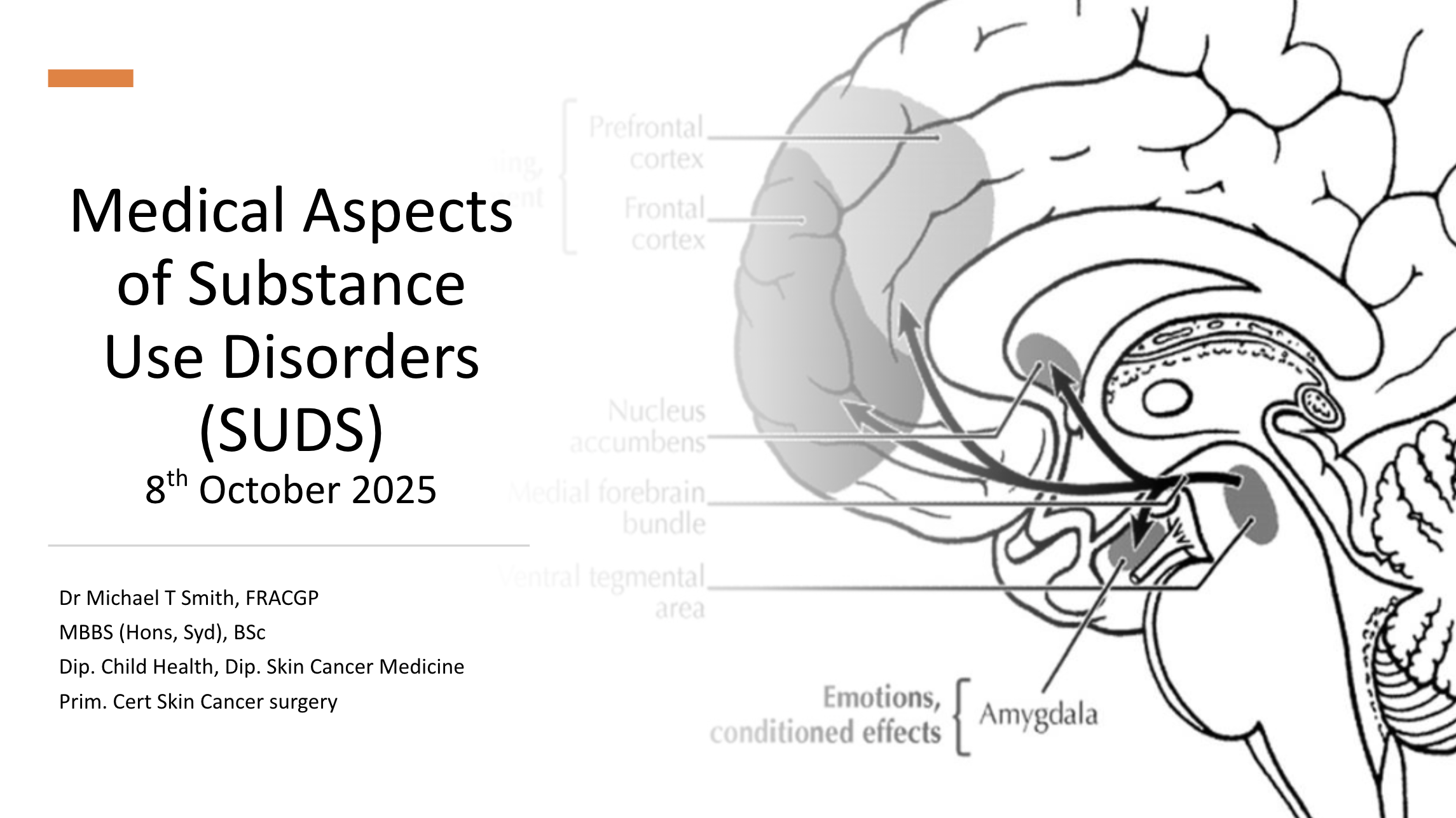 Understanding Substance Use: Insights from Dr Michael Smith at the 12 Months On Conference