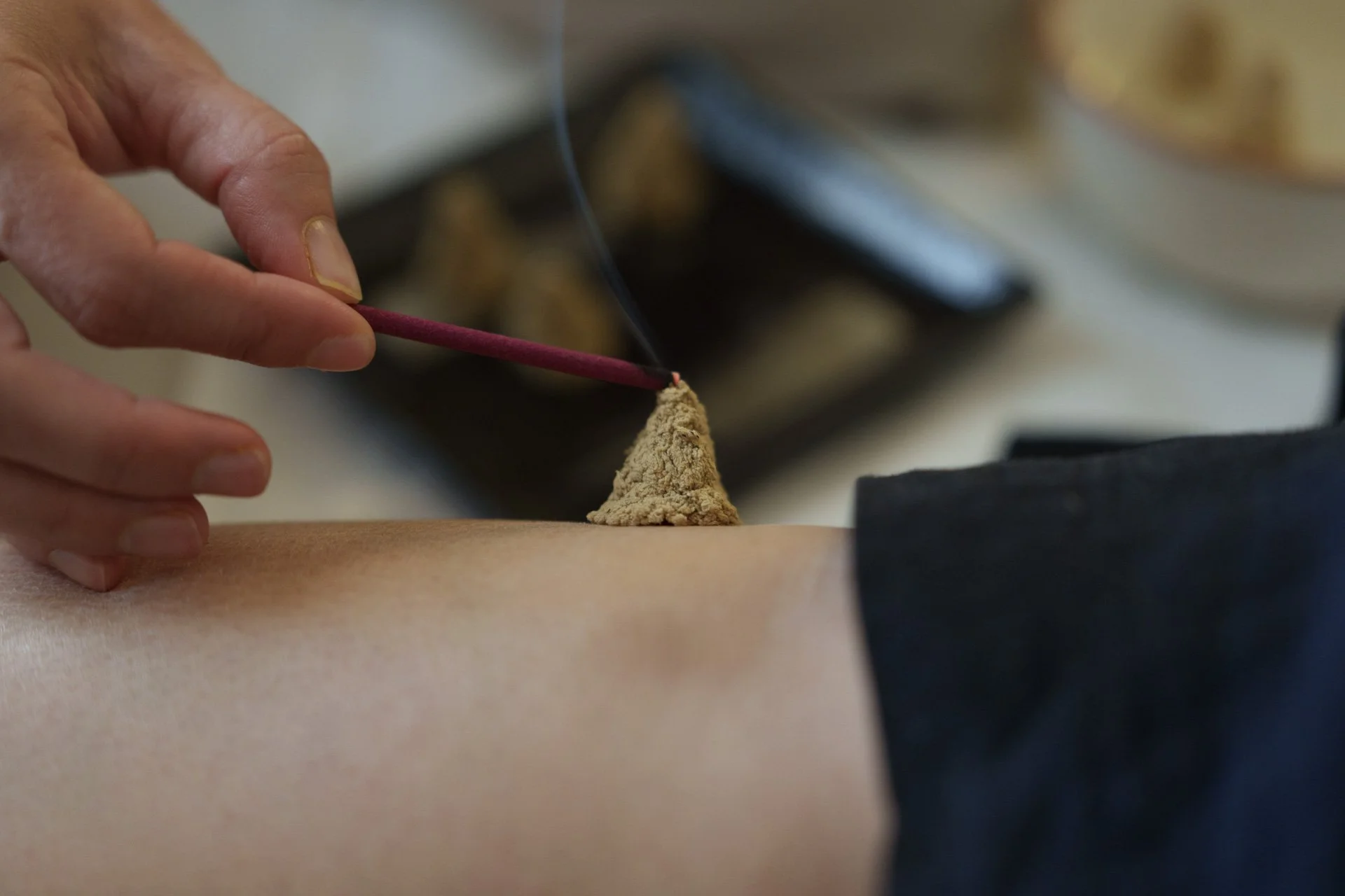 A person applying moxibustion to a person's back with an incense stick during a treatment.