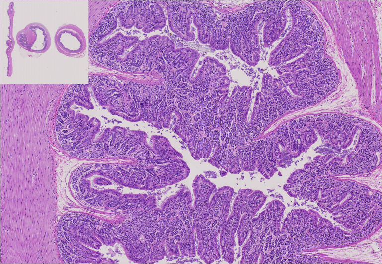 14.Large intestine.png