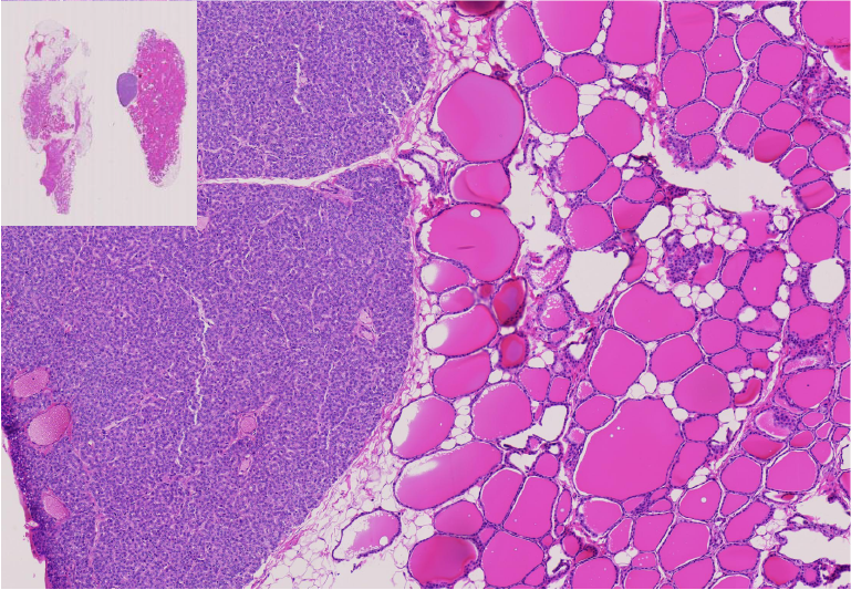 11.Thyroid gland.png
