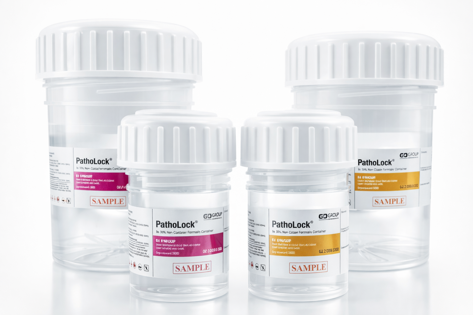Four clear plastic specimen containers with white screw-on lids, labeled with 'PathoLock' and 'SAMPLE' stickers, on a white background.
