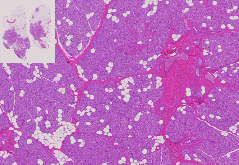 10.Parotid gland.png