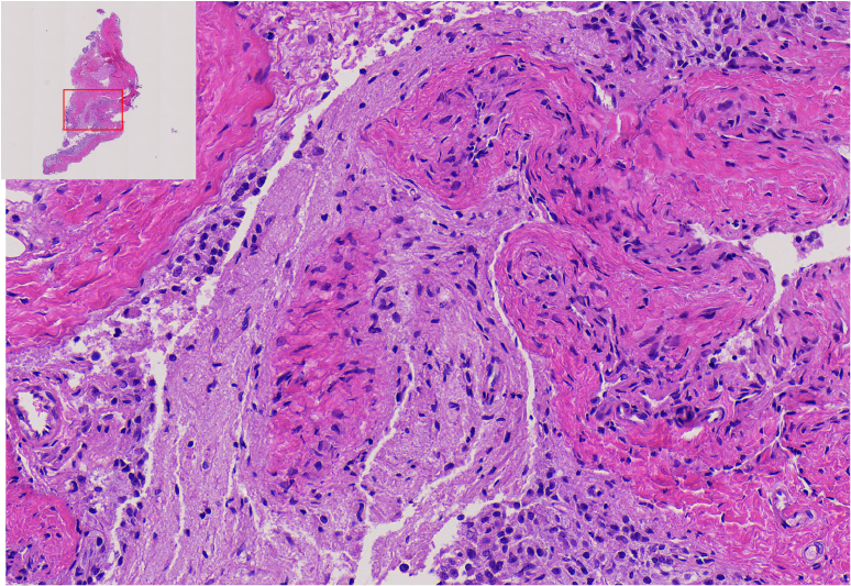 03.Pituitary gland.png