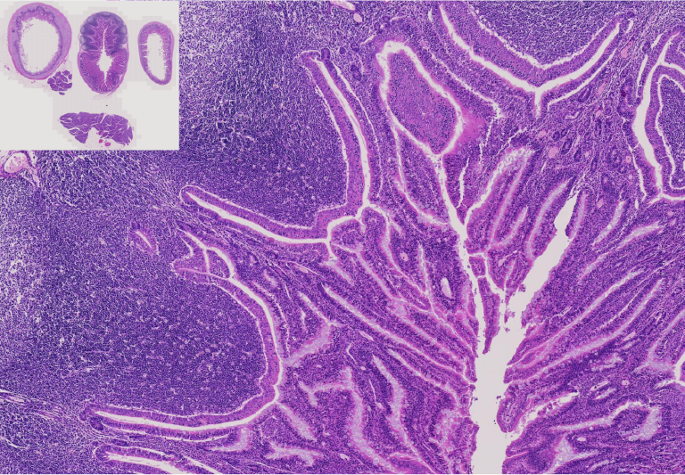 13.Small intestine.png