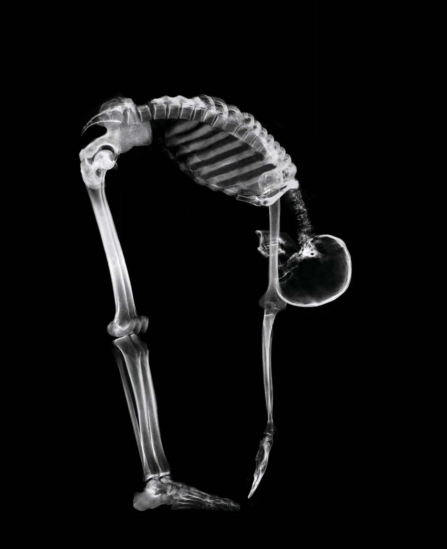X-ray image of a body reaching down to feet, showing its skull, spine, ribcage, and legs against a black background.