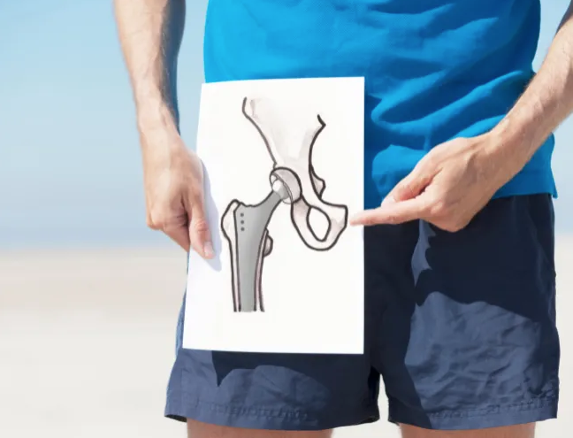 What NOT to do After a Hip Replacement