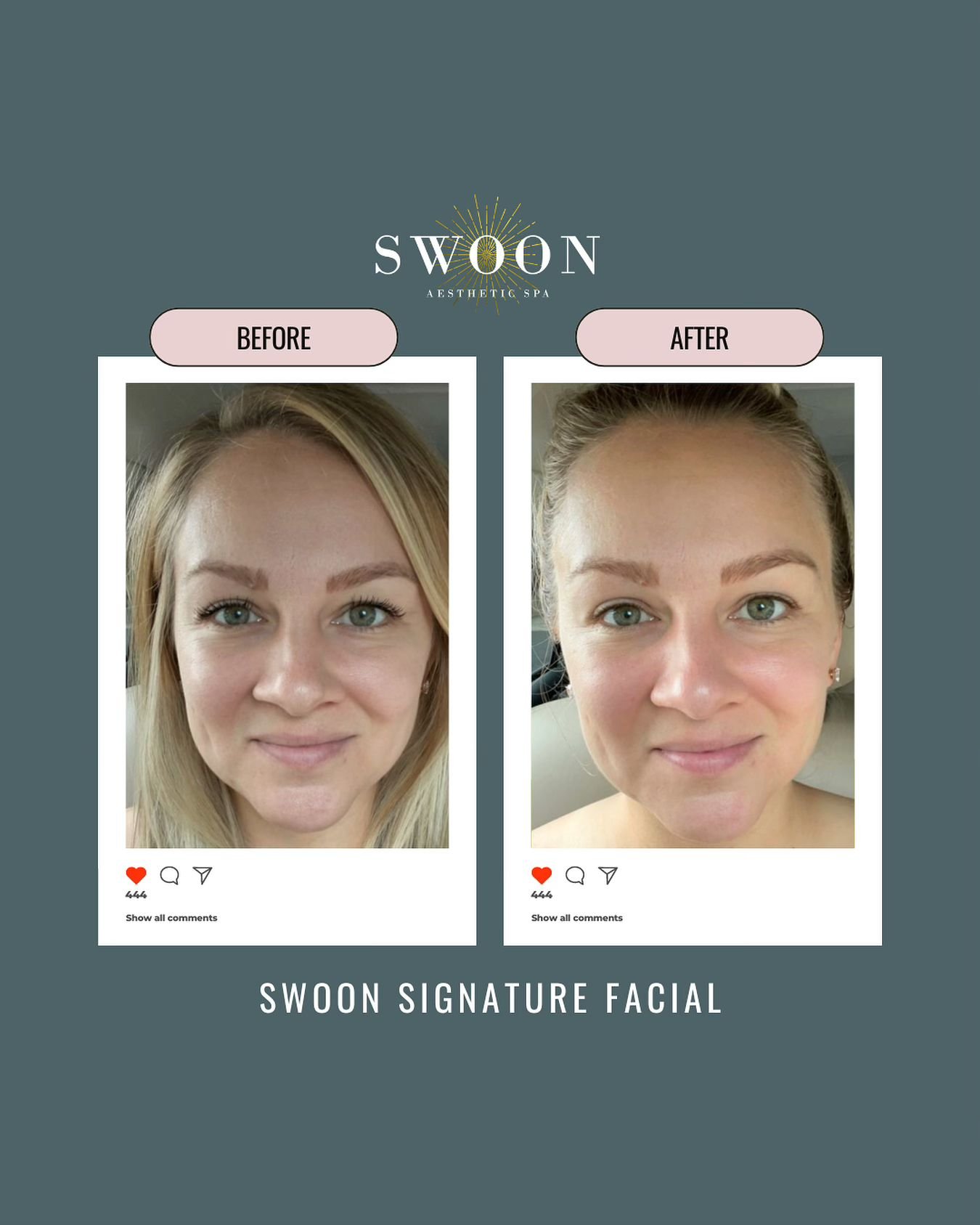 Does your skin need a refresh and a glow up? ✨ Our expert team customizes every step to ensure your skin looks and feels its absolute best. 

Experience deep cleansing, rejuvenation, and intense hydration for that beautiful glow. Girl, book that appo