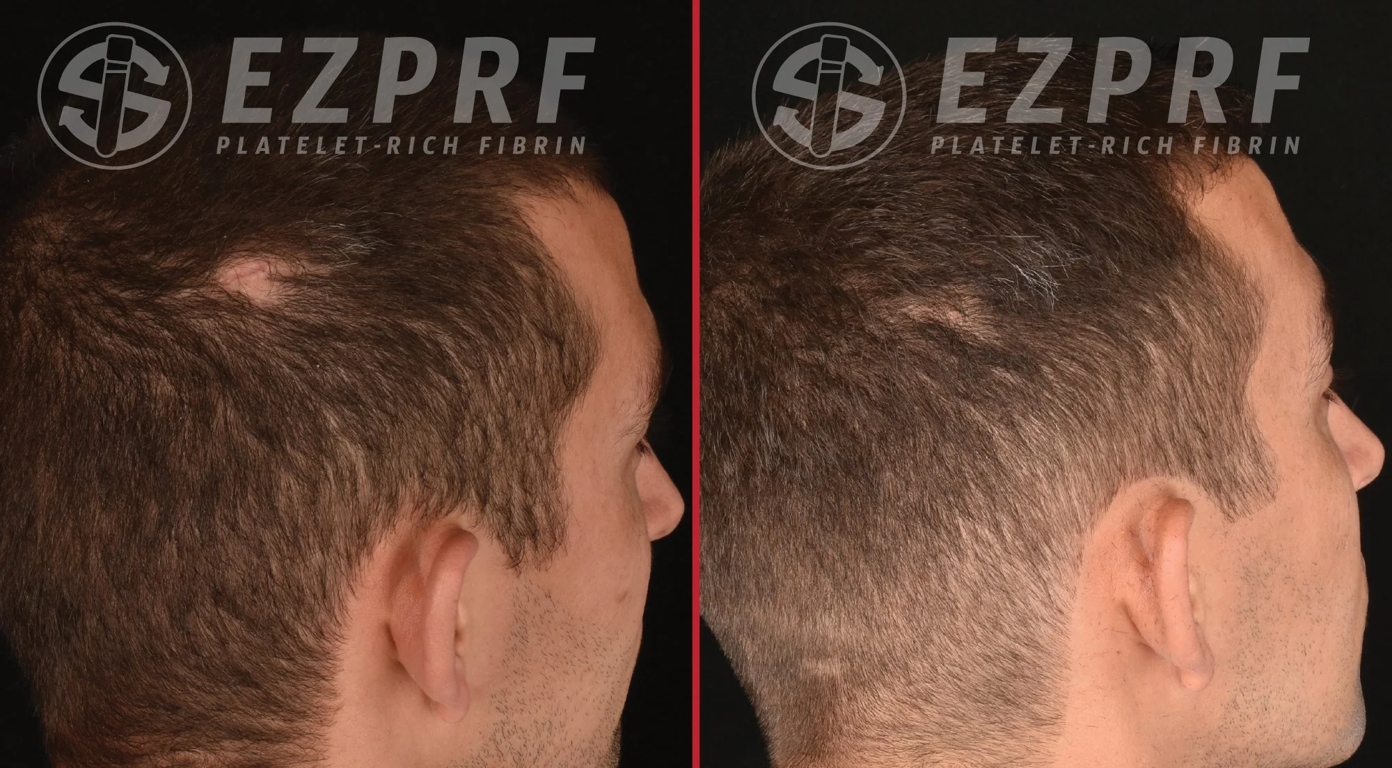 bna-ez-hair-2.jpg