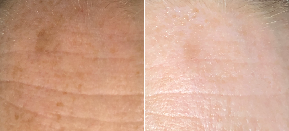 IPL B&A 2.png