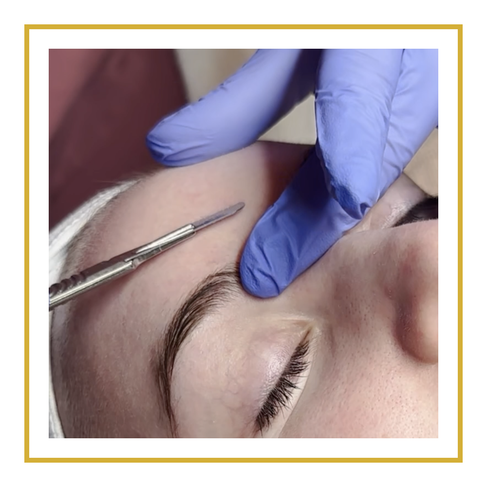 CONCERNS_dermaplaning.png