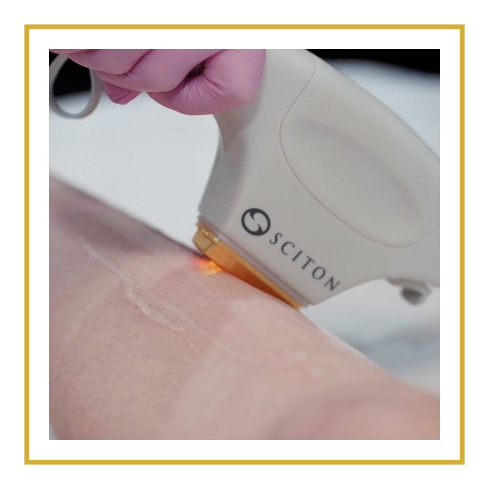 Patient_resources_laser_hair_removal2.png