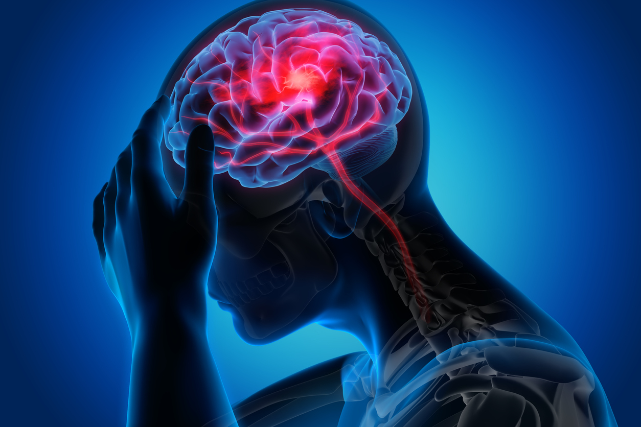 Headache/cervical spine/Migrane therapy
