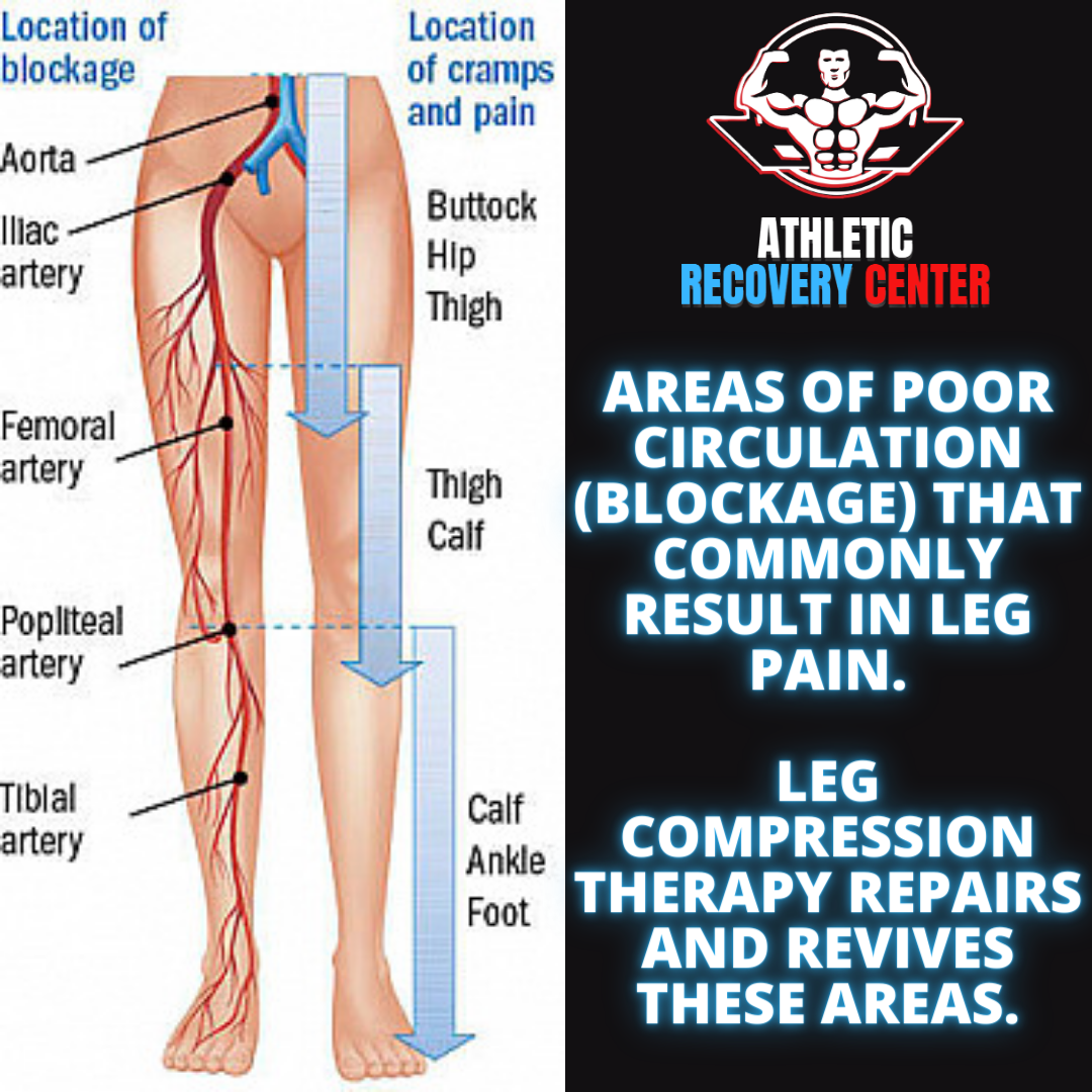 What is Compression Therapy? — The Athletic Recovery Center Powered By American Fitness Center