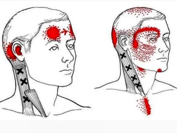 #rainyday in #Toronto often causes a headache or two. Pressure change in the atmosphere can trigger a variety of responses in the body. #massagetherapy can help with those pesky #headaches. Link in bio for booking at @adelaidewestphysio or @gesundto.