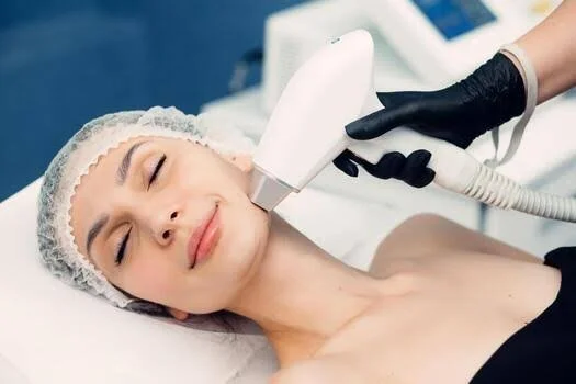 face laser hair removal