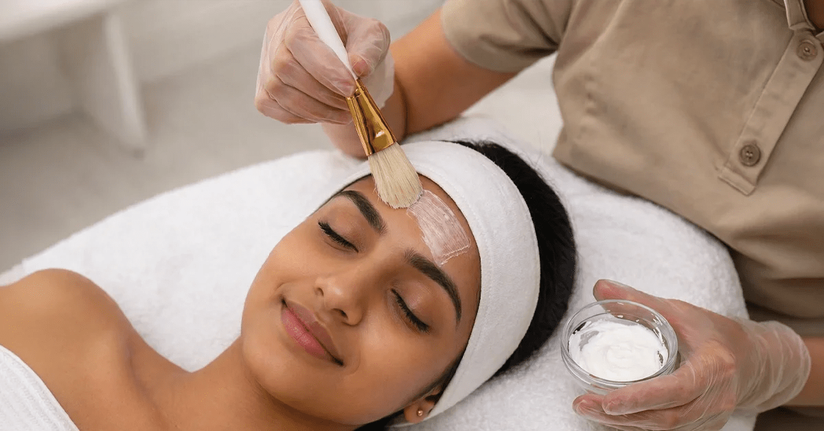 chemical peel