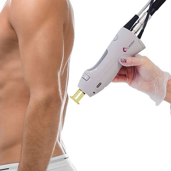 laser hair removal on the Full back