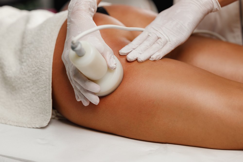 cellulite treatment near me