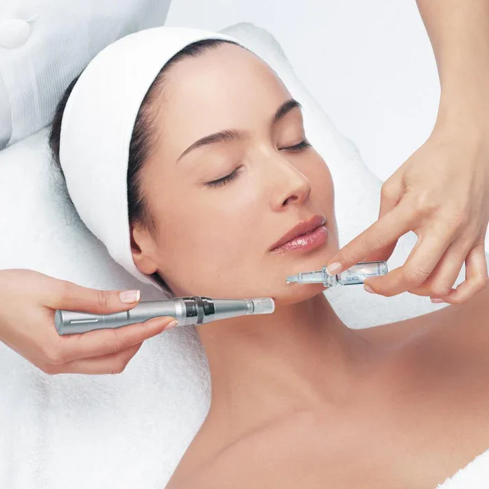 microneedling for acne scars in queens NY