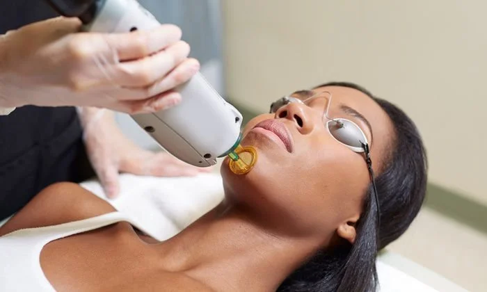 Laser hair removal near me