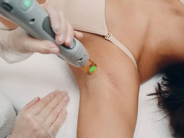 Underarm Laser-Hair Removal